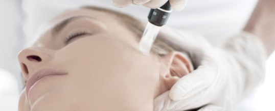 Why Microneedling Is the Next Big Thing in Skin Care